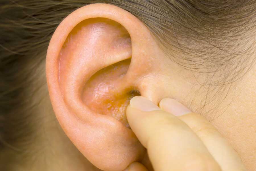 Itchy Ears In Perimenopause & Menopause: Why It Happens & What Helps