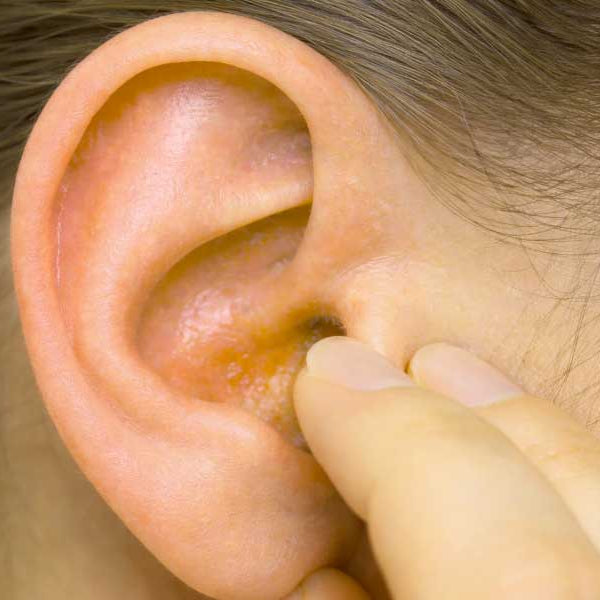 woman itching her ear